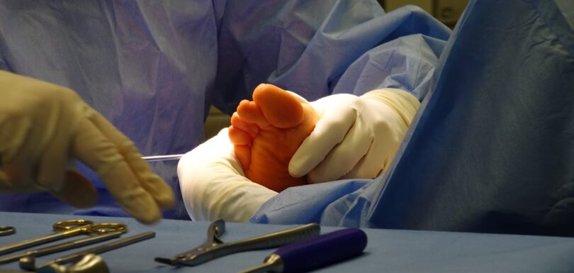 nail surgery oldham