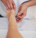 Ace-Clinic-Acupuncture--image-02