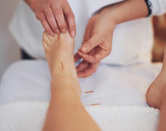 Ace-Clinic-Acupuncture--image-02