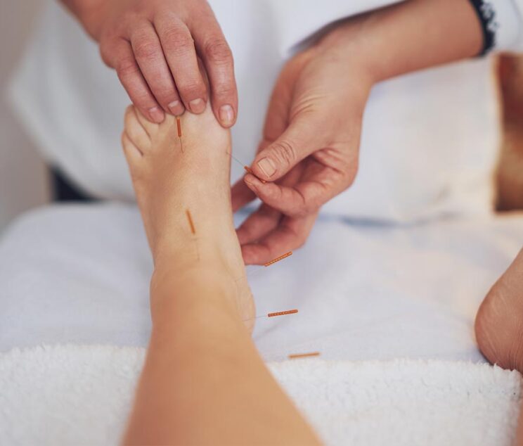 Ace-Clinic-Acupuncture--image-02