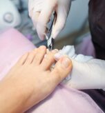 Ace-Clinic-Nail-Surgery-Image-03