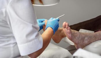 Ace-Clinic-Routine-Chiropody-image-01